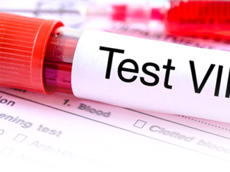 «Uno de cada tres muertos por sida no tenía servicios de salud»