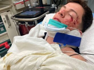 Guaynaa sufre fuerte accidente automovilístico en Los Ángeles