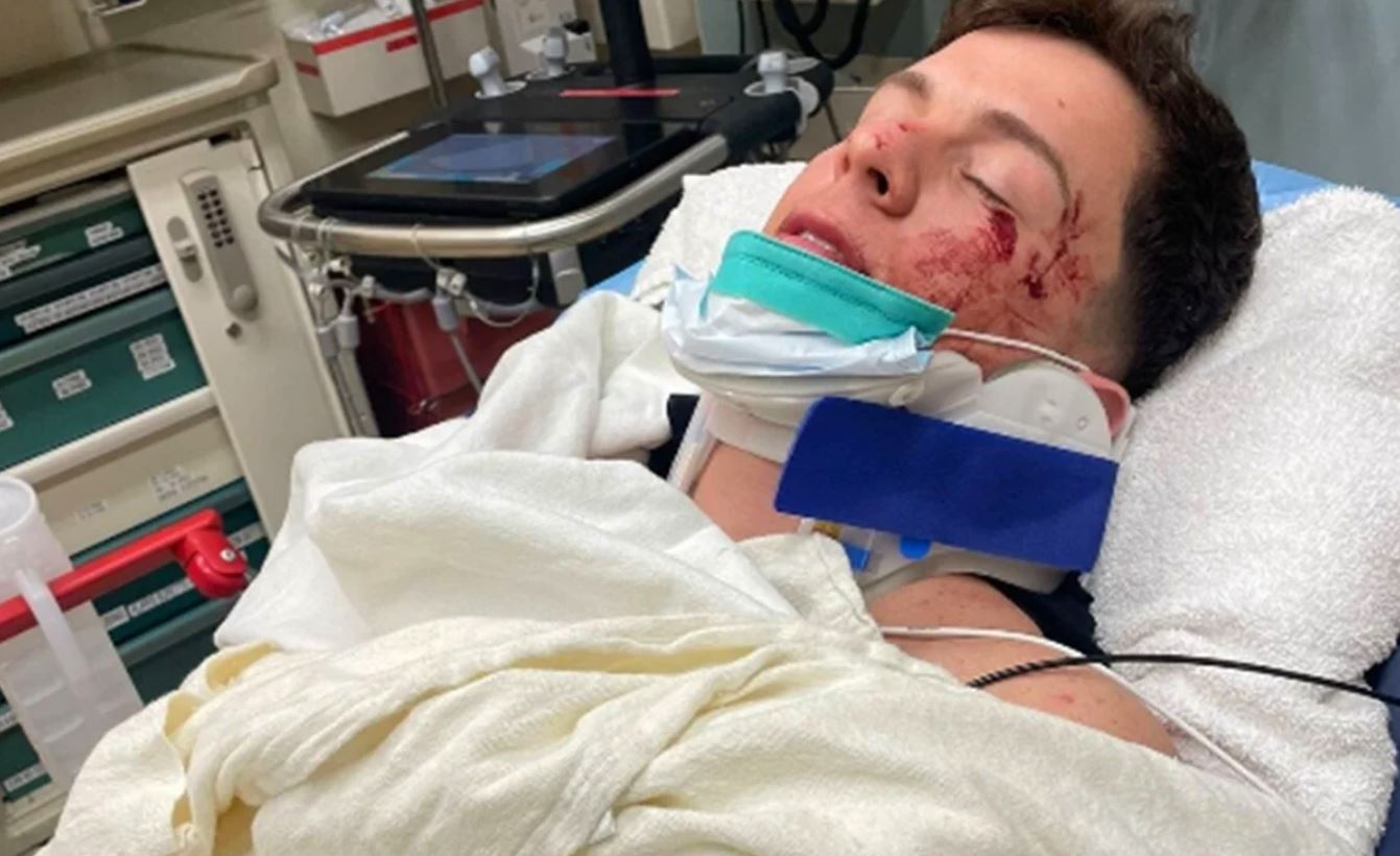 Guaynaa sufre fuerte accidente automovilístico en Los Ángeles