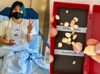 «Ahora sí, ya no más operaciones»: Alexa Moreno se somete a una artroscopia