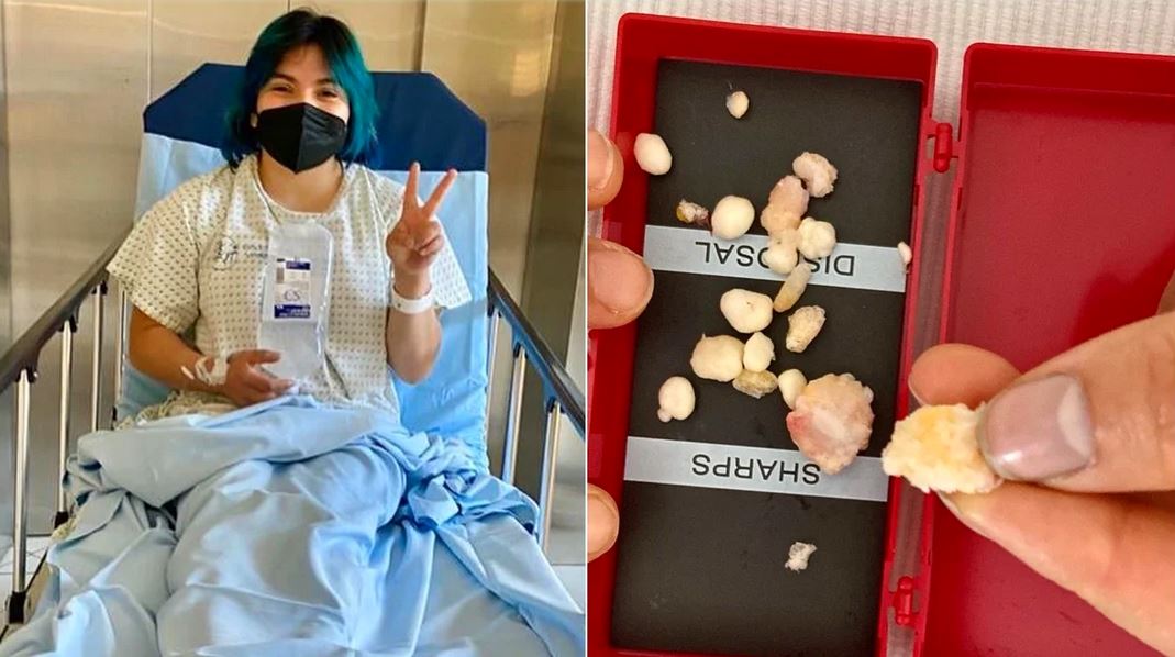 «Ahora sí, ya no más operaciones»: Alexa Moreno se somete a una artroscopia