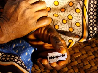 En medio del sesgo de género, la ONU busca erradicar la mutilación genital de la mujer para 2030