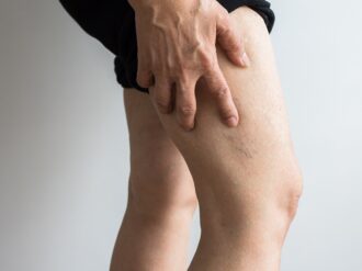 Vacuna AstraZeneca: riesgo de trombosis aumenta con su aplicación