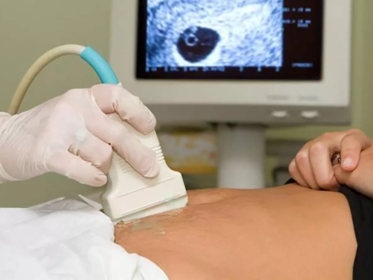 Tras 20 años de haberse practicado un aborto voluntario, Flor logró perdonarse.