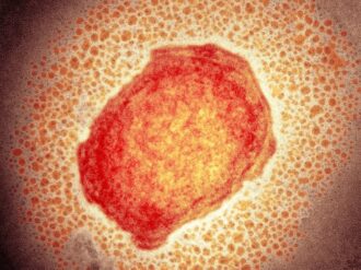 Qué es la viruela de mono detectada ya en Norteamérica y qué riesgos tiene para la salud