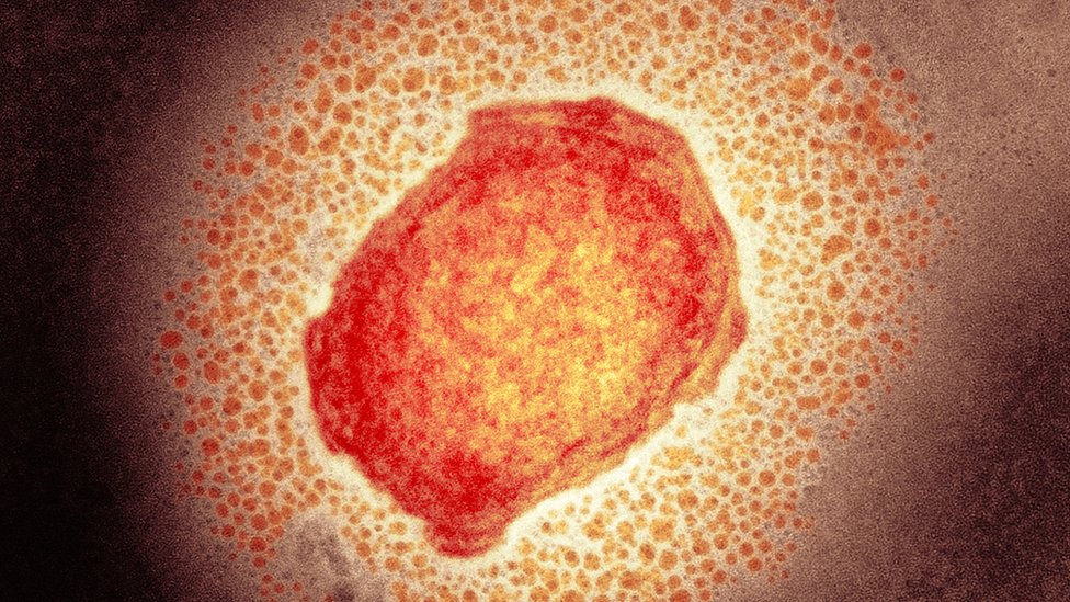 Qué es la viruela de mono detectada ya en Norteamérica y qué riesgos tiene para la salud