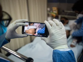 Detectan por primera vez viruela del mono, Covid-19 y VIH al mismo tiempo en paciente italiano