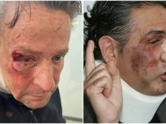 Alfredo Adame muestra su rostro tras cirugía: «A Fabiruchis le pegaron más»