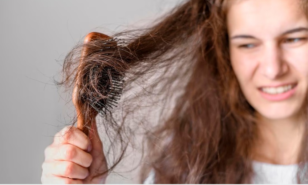 Alimentos que aceleran la caída del cabello