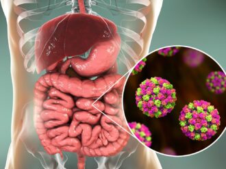 Norovirus, causante de enfermedades gastrointestinales