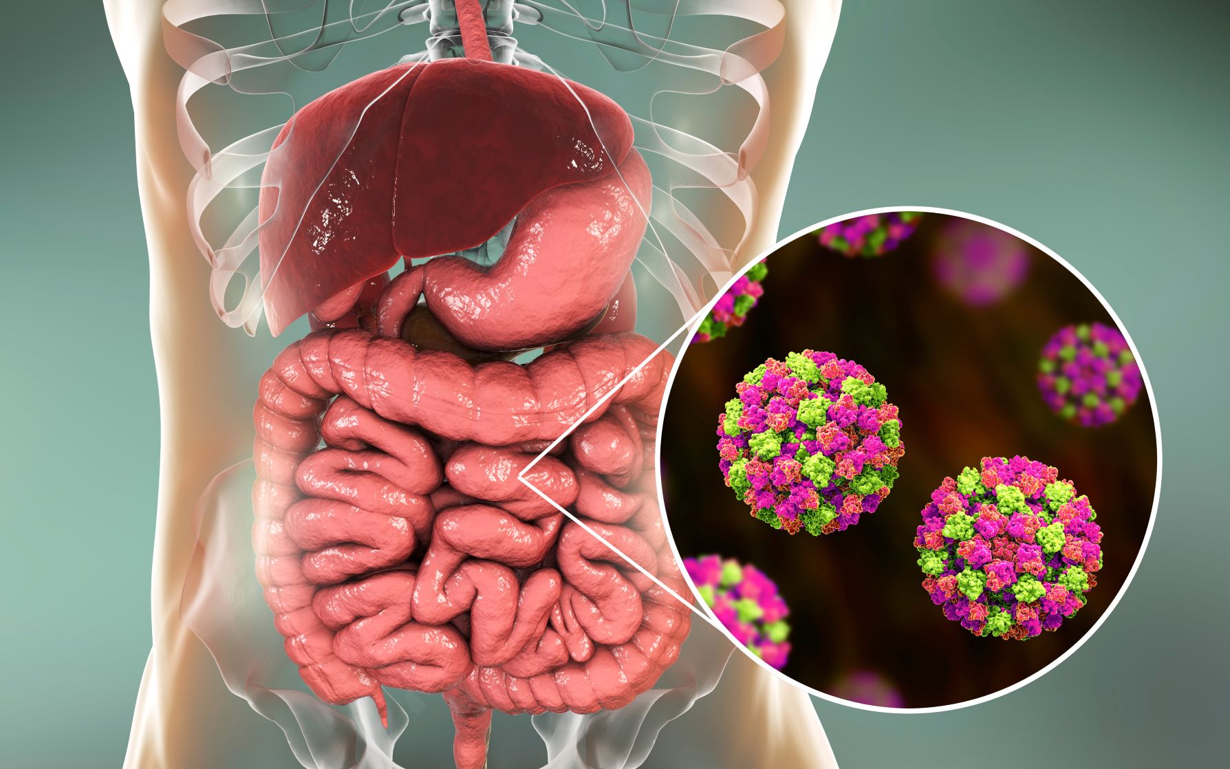 Norovirus, causante de enfermedades gastrointestinales