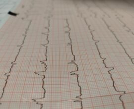 Diferentes, síntomas de ataques cardiacos en hombres y mujeres 