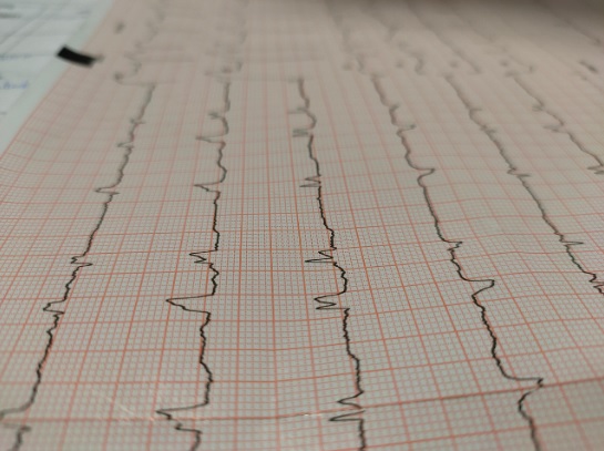 Diferentes, síntomas de ataques cardiacos en hombres y mujeres
