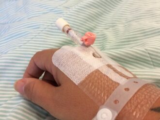 En terapia intensiva, joven mordida por un zorrillo 