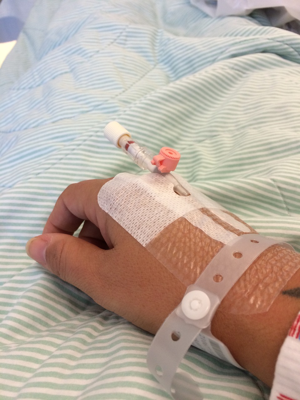 En terapia intensiva, joven mordida por un zorrillo 