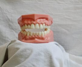 DIF ofrece placas dentales gratuitas para adultos mayores 