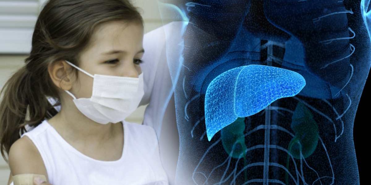 Por el momento no se registran casos de hepatitis infantil aguda en México