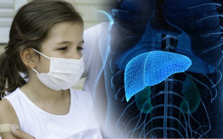 Por el momento no se registran casos de hepatitis infantil aguda en México