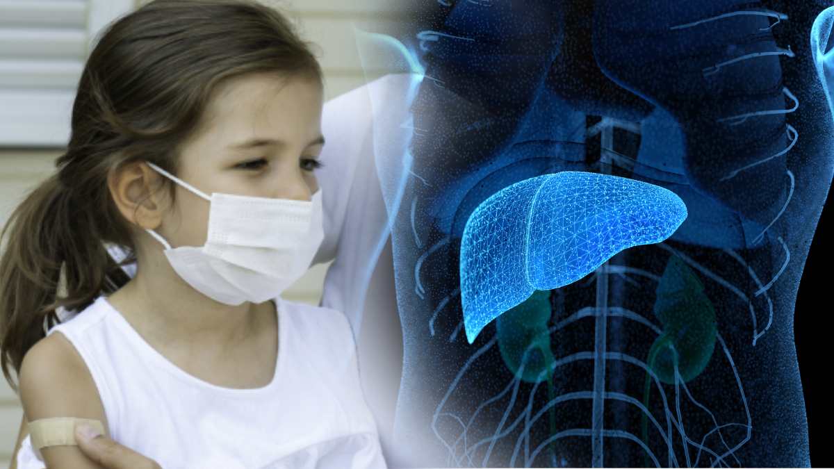 Por el momento no se registran casos de hepatitis infantil aguda en México