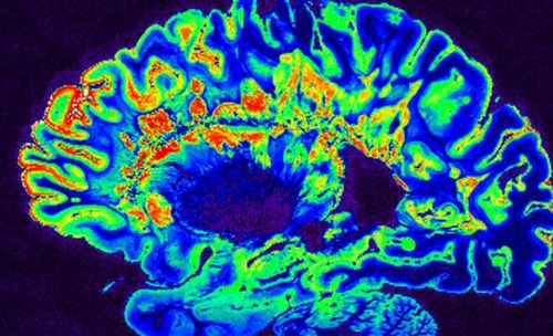 Se registra por primera vez la actividad cerebral justo antes de la muerte