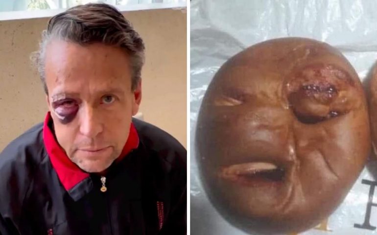 Tras golpiza, lanzan pan de Alfredo Adame