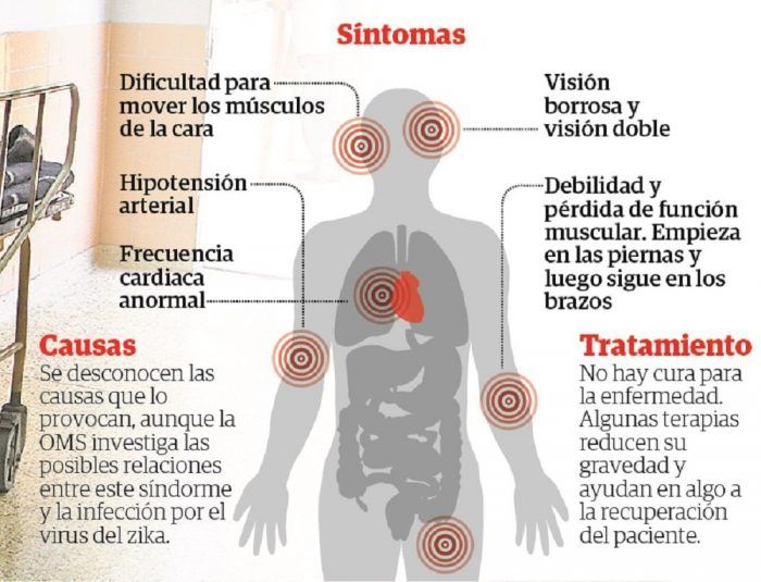 Perú emite emergencia sanitaria por brote inusual del síndrome de Guillain-Barré