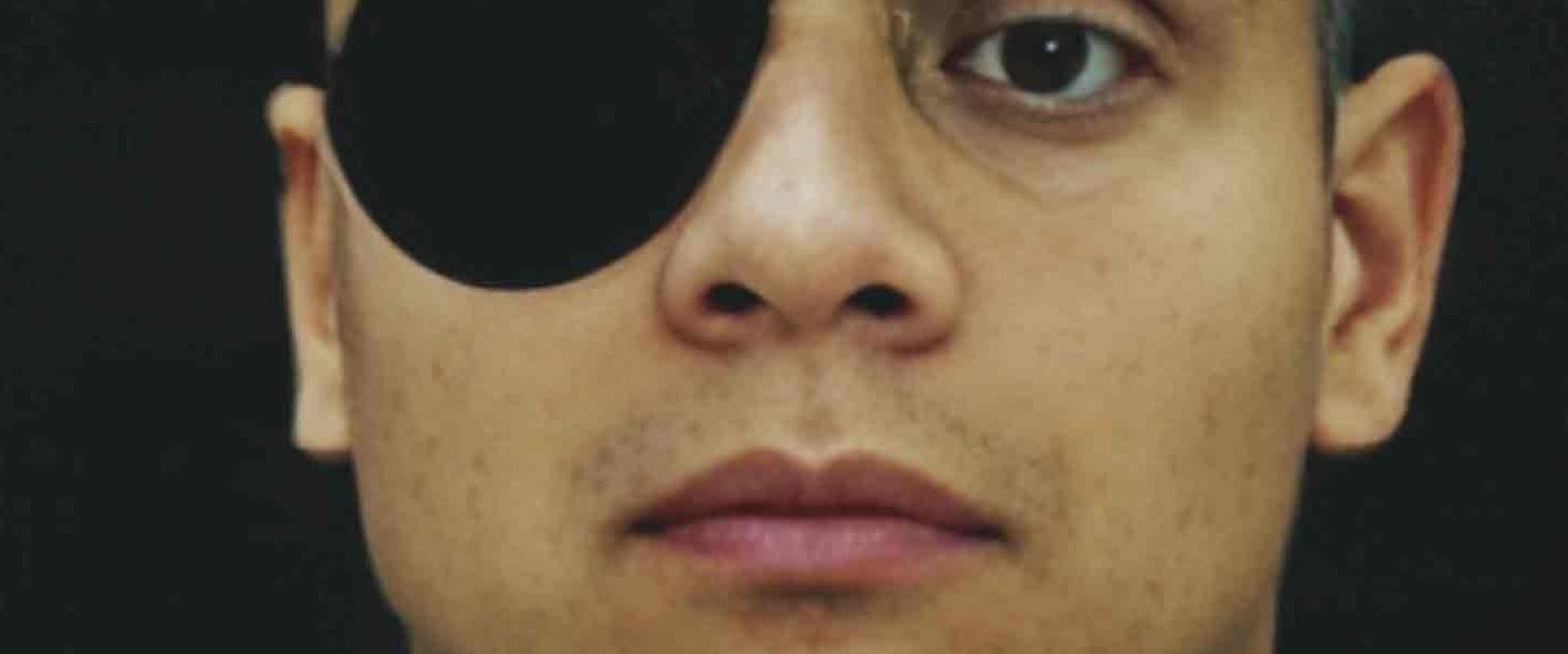 ¿Porque El Neto usaba un parche en su ojo derecho?