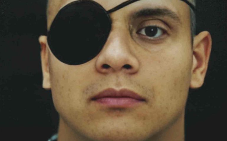 ¿Porque El Neto usaba un parche en su ojo derecho?