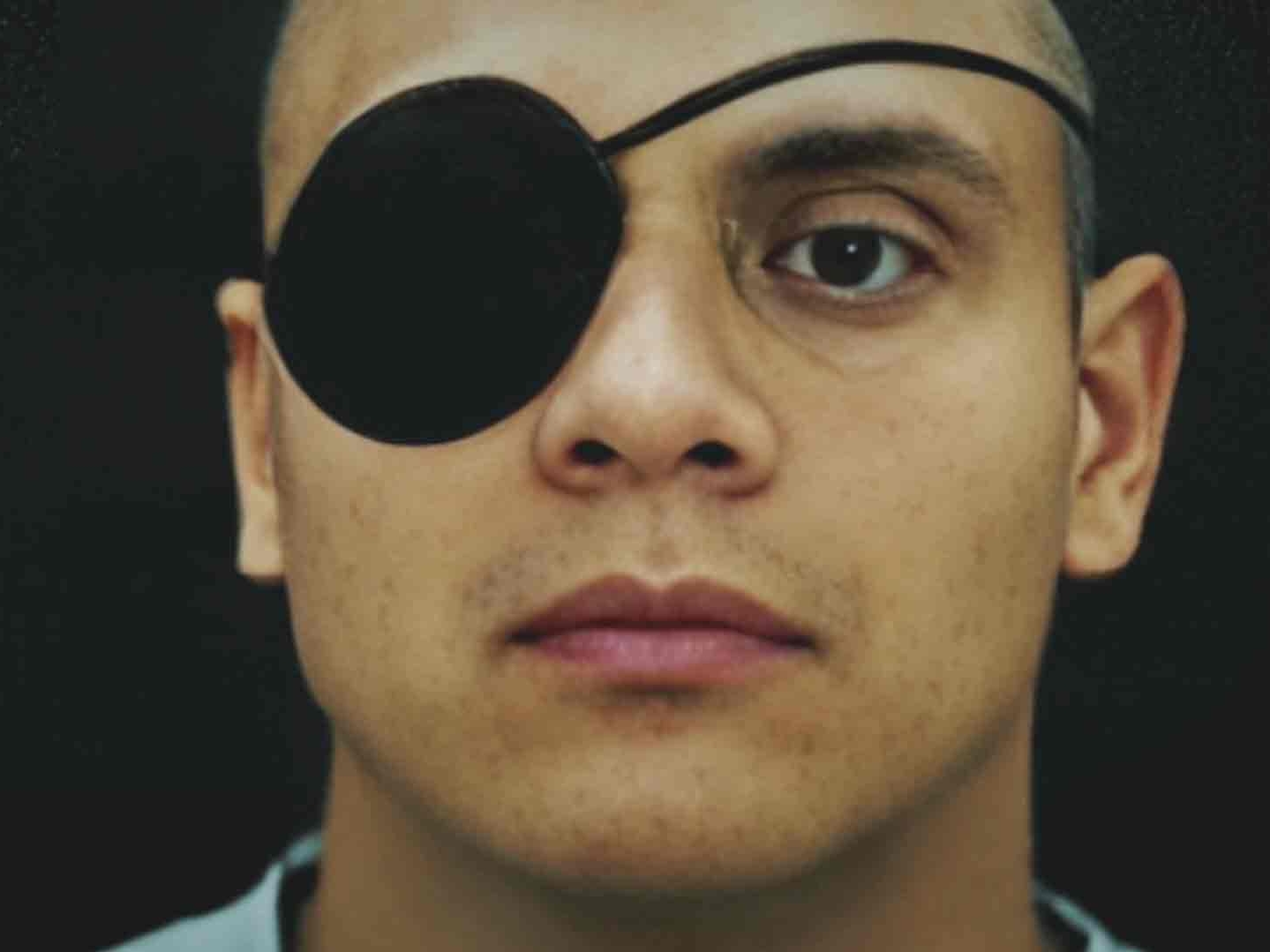 ¿Porque El Neto usaba un parche en su ojo derecho?
