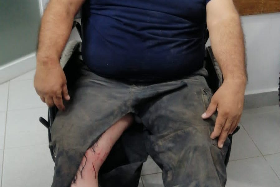 ASÍ QUEDARON LAS PERSONAS HERIDAS POR BOMBAS DETONADAS EN JALISCO