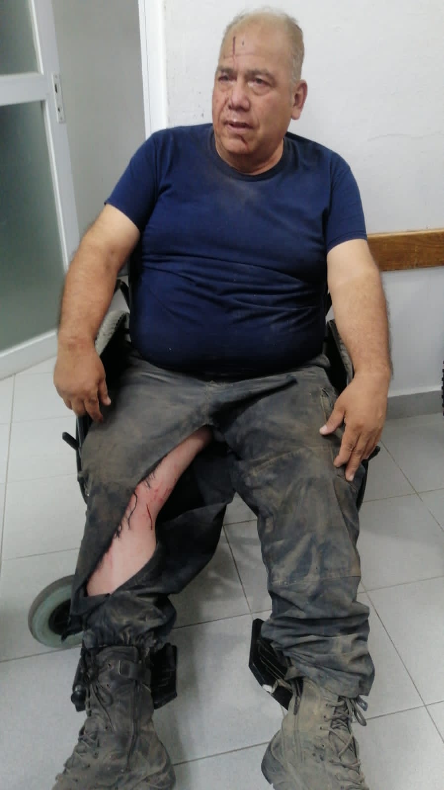 ASÍ QUEDARON LAS PERSONAS HERIDAS POR BOMBAS DETONADAS EN JALISCO