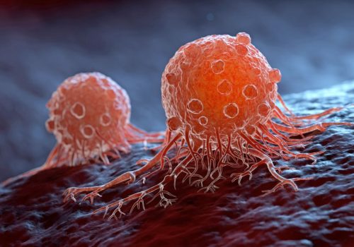 Hasta el 80% de cáncer detectados a tiempo se pueden curar